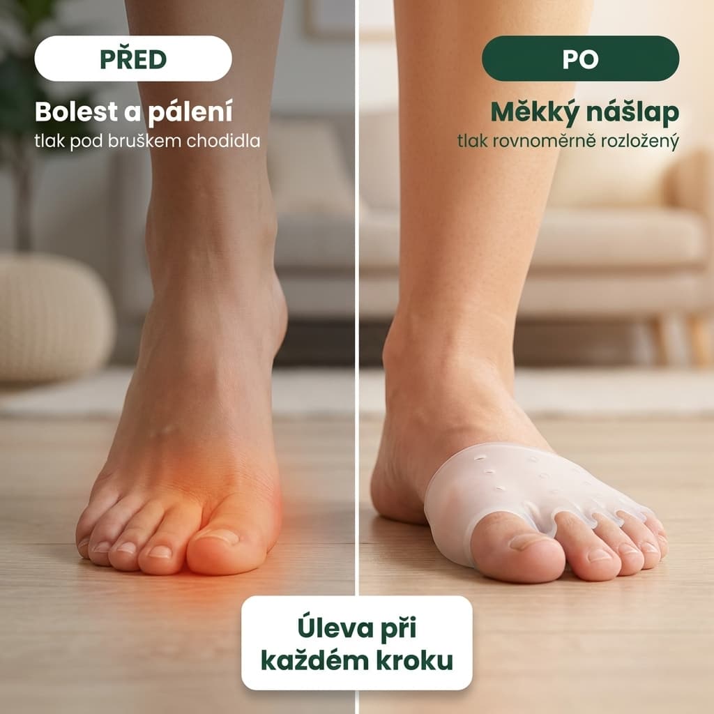 Silikonový polštářek pod přední část chodidla před a po – měkký nášlap bez bolesti